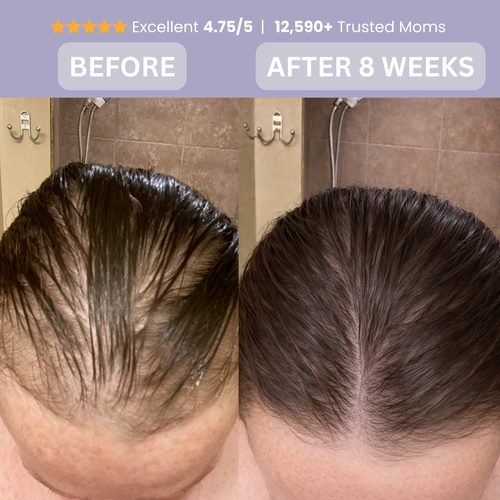 Regrow the hair you lost after giving birth within 8 Weeks