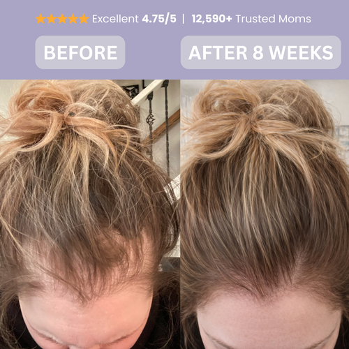 Regrow the hair you lost after giving birth within 8 Weeks