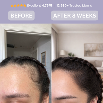 Regrow the hair you lost after giving birth within 8 Weeks